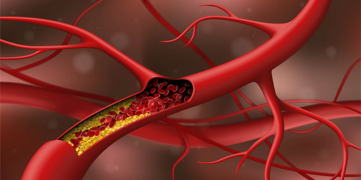 Cholesterol isn’t a villain—it’s more like a double-edged sword. Your body needs it, but too much in the wrong form can quietly put your life at risk. The key is balance, and that comes from smart lifestyle choices, regular testing, and, when necessary, medication.